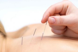 acupuncturepic